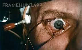 Alex DeLarge is strapped to a chair, screaming as his eyelids are forcibly held open by metal clamps. in A Clockwork Orange